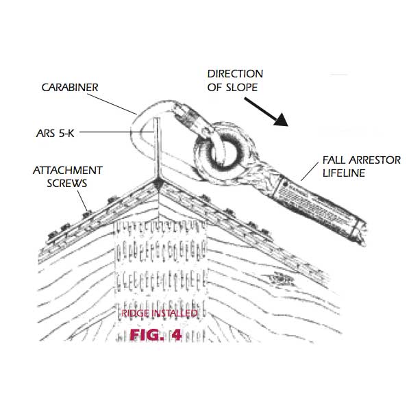 Super Anchor Stainless Steel Reusable Anchor - Ridge Installation